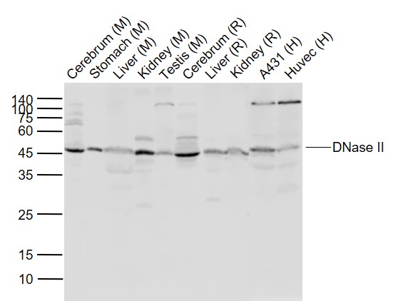 Lane 1: Mouse Cerebrum lysates; Lane 2: Mouse stomach lysates; Lane 3: Mouse Liver lysates; Lane 4: Mouse Kidney lysates ; Lane 5: Mouse Testis lysates;Lane 6: Rat Cerebrum lysates; Lane 7: Rat Liver cell lysates; Lane 8: Rat Kidney lysates; Lane 9: Human A431 cell lysates; Lane 10: Human Huvec lysates probed with DNase II Polyclonal Antibody, Unconjugated (bs-23335R) at 1:1000 dilution and 4˚C overnight incubation. Followed by conjugated secondary antibody incubation at 1:20000 for 60 min at 37˚C.