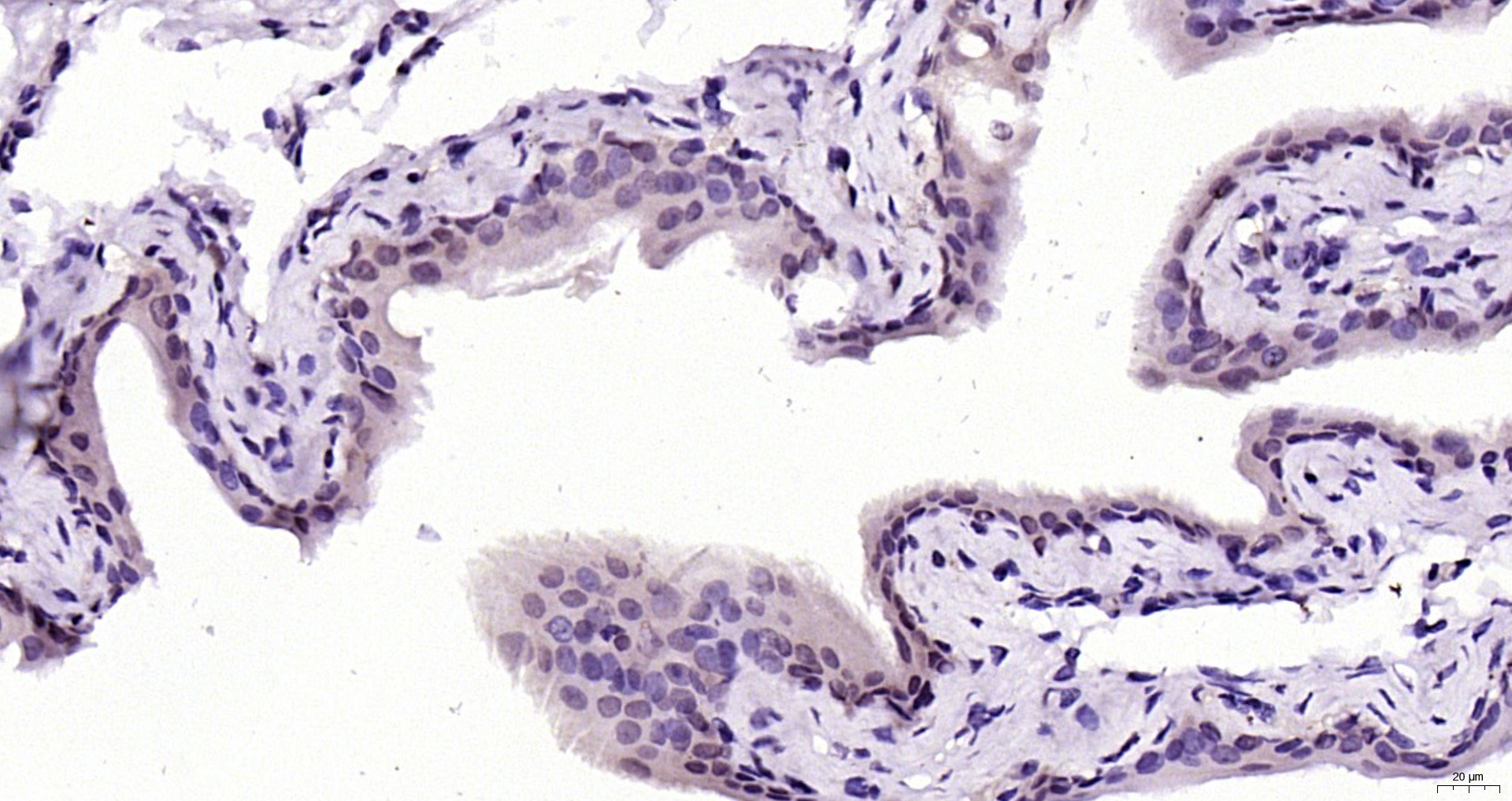 Paraformaldehyde-fixed, paraffin embedded Mouse bladder; Antigen retrieval by boiling in sodium citrate buffer (pH6.0) for 15min; Block endogenous peroxidase by 3% hydrogen peroxide for 20 minutes; Blocking buffer (normal goat serum) at 37°C for 30min; Antibody incubation with CNOT2 Polyclonal Antibody, Unconjugated (bs-9383R) at 1:200 overnight at 4°C, DAB staining.