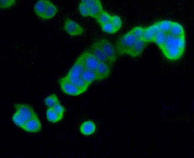 PC12 cell; 4% Paraformaldehyde-fixed; Triton X-100 at room temperature for 20 min; Blocking buffer (normal goat serum) at 37°C for 20 min; Antibody incubation with (DUSP6 (9C3) )Monoclonal Antibody, Unconjugated (bsm-52270R) 1:50, 90 minutes at 37°C; followed by a conjugated Goat Anti-Rabbit IgG antibody at 37°C for 90 minutes, DAPI (blue) was used to stain the cell nuclei.
