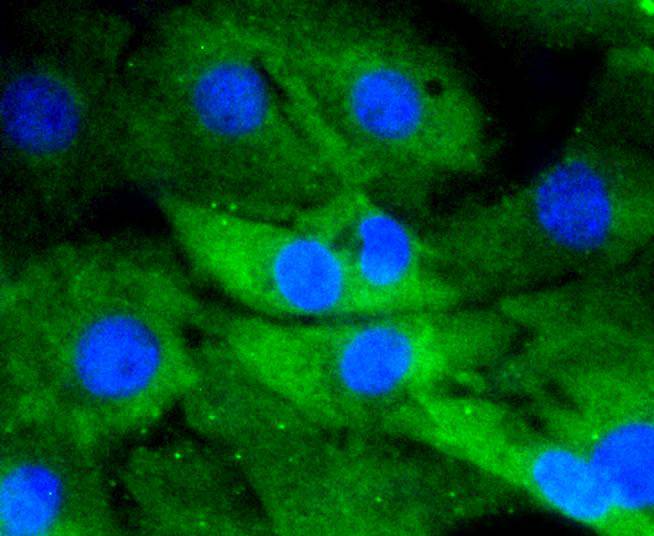 NIH/3T3 cell; 4% Paraformaldehyde-fixed; Triton X-100 at room temperature for 20 min; Blocking buffer (normal goat serum) at 37°C for 20 min; Antibody incubation with (_x000D_ DUSP6 (9C3)) Monoclonal Antibody, Unconjugated (bsm-52270R) 1:50, 90 minutes at 37°C; followed by a conjugated Goat Anti-Rabbit IgG antibody at 37°C for 90 minutes, DAPI (blue) was used to stain the cell nuclei.