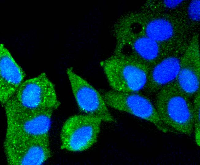 Hela cell; 4% Paraformaldehyde-fixed; Triton X-100 at room temperature for 20 min; Blocking buffer (normal goat serum) at 37°C for 20 min; Antibody incubation with (ATM (12A)) Monoclonal Antibody, Unconjugated (bsm-52360R) 1:50, 90 minutes at 37°C; followed by a conjugated Goat Anti-Rabbit IgG antibody at 37°C for 90 minutes, DAPI (blue) was used to stain the cell nuclei.
