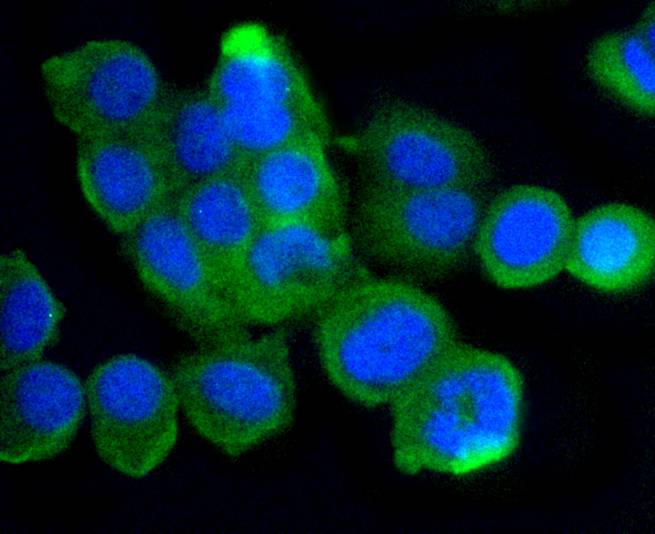 MCF7 cell; 4% Paraformaldehyde-fixed; Triton X-100 at room temperature for 20 min; Blocking buffer (normal goat serum) at 37°C for 20 min; Antibody incubation with (ATM (12A)) Monoclonal Antibody, Unconjugated (bsm-52360R) 1:50, 90 minutes at 37°C; followed by a conjugated Goat Anti-Rabbit IgG antibody at 37°C for 90 minutes, DAPI (blue) was used to stain the cell nuclei.