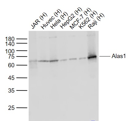 Lane 1: Human JAR cell lysates; Lane 2: Human Huvec cell lysates; Lane 3: Human Hela cell lysates; Lane 4: Human HepG2 cell lysates ; Lane 5: Human MCF-7 cell lysates; Lane 6: Human K562 cell lysates; Lane 7: Human Raji cell lysates probed with Alas1 (1G11) Monoclonal Antibody, Unconjugated (bsm-52012R) at 1:1000 dilution and 4˚C overnight incubation. Followed by conjugated secondary antibody incubation at 1:20000 for 60 min at 37˚C. Lane 1: Human JAR cell lysates; Lane 2: Human Huvec cell lysates; Lane 3: Human Hela cell lysates; Lane 4: Human HepG2 cell lysates ; Lane 5: Human MCF-7 cell lysates; Lane 6: Human K562 cell lysates; Lane 7: Human Raji cell lysates probed with Alas1 (1G11) Monoclonal Antibody, Unconjugated (bsm-52012R) at 1:1000 dilution and 4˚C overnight incubation. Followed by conjugated secondary antibody incubation at 1:20000 for 60 min at 37˚C.