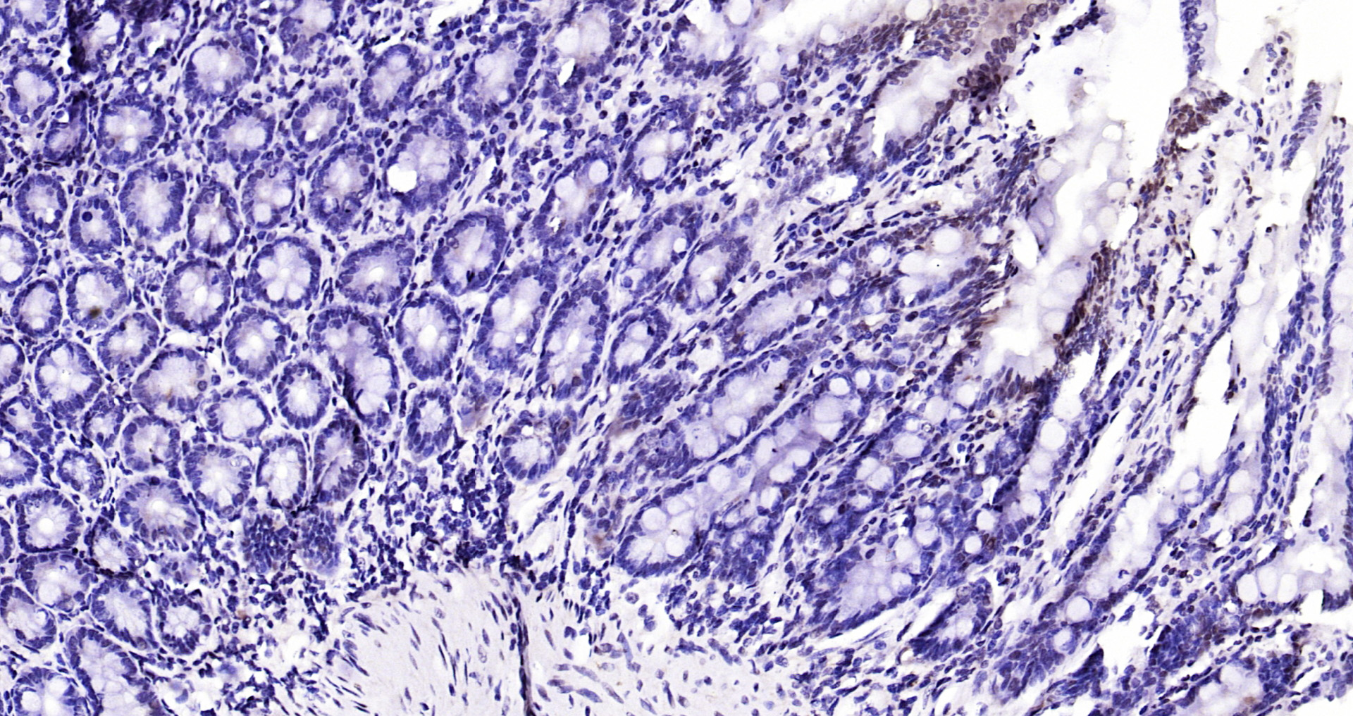Paraformaldehyde-fixed, paraffin embedded Human intestine; Antigen retrieval by boiling in sodium citrate buffer (pH6.0) for 15min; Block endogenous peroxidase by 3% hydrogen peroxide for 20 minutes; Blocking buffer (normal goat serum) at 37°C for 30min; Antibody incubation with NCOA4 Polyclonal Antibody, Unconjugated (bs-19051R) at 1:200 overnight at 4°C, DAB staining.