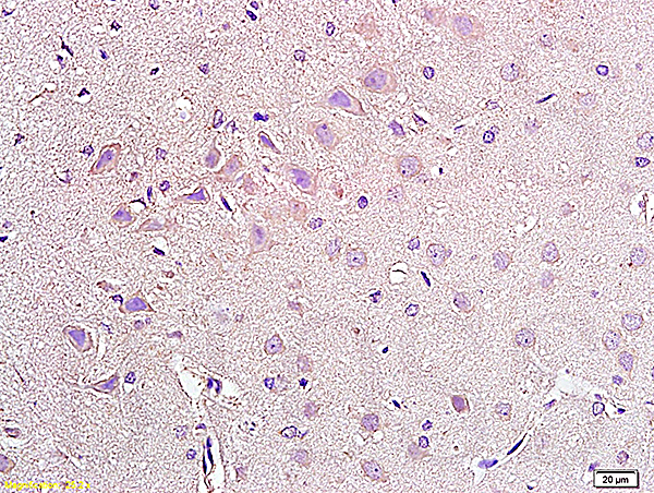 Formalin-fixed and paraffin embedded rat brain tissue labeled with Anti-NPY2R Polyclonal Antibody, Unconjugated (bs-0937R) at 1:200, followed by conjugation to the secondary antibody and DAB staining
