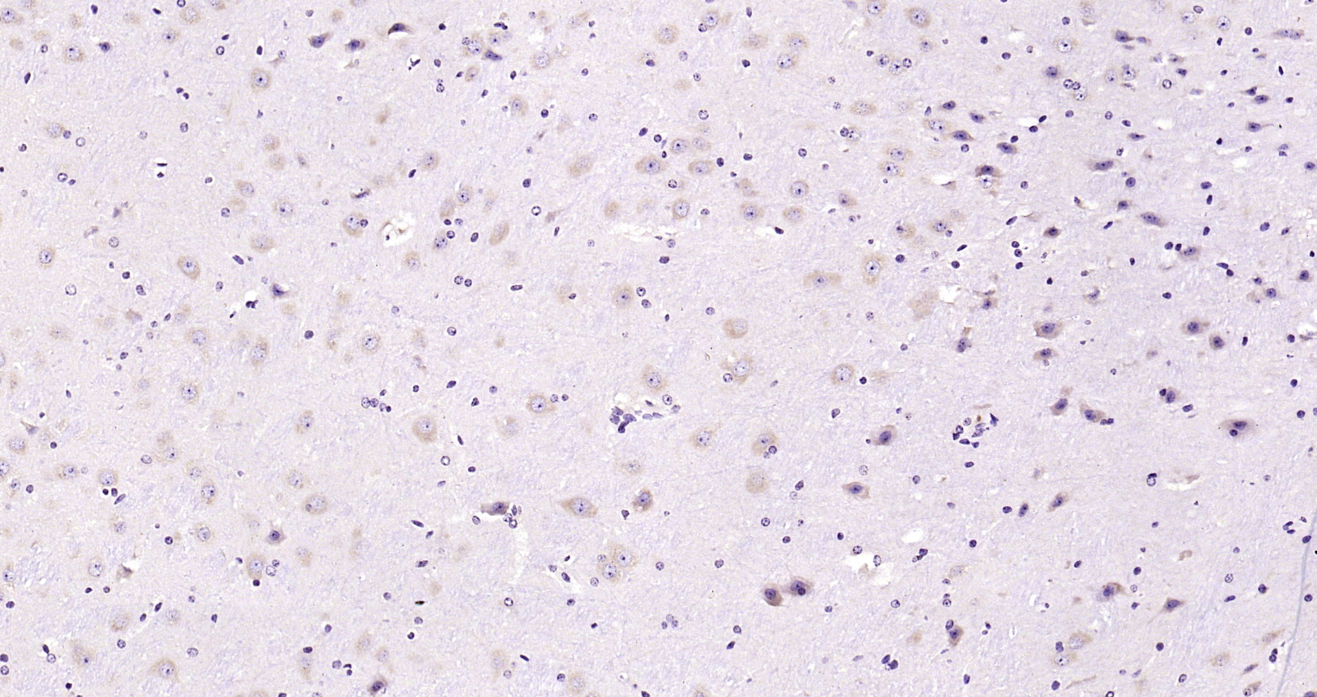 Paraformaldehyde-fixed, paraffin embedded Mouse brain; Antigen retrieval by boiling in sodium citrate buffer (pH6.0) for 15min; Block endogenous peroxidase by 3% hydrogen peroxide for 20 minutes; Blocking buffer (normal goat serum) at 37°C for 30min; Antibody incubation with LIP5 Polyclonal Antibody, Unconjugated (bs-24470R) at 1:200 overnight at 4°C, DAB staining.