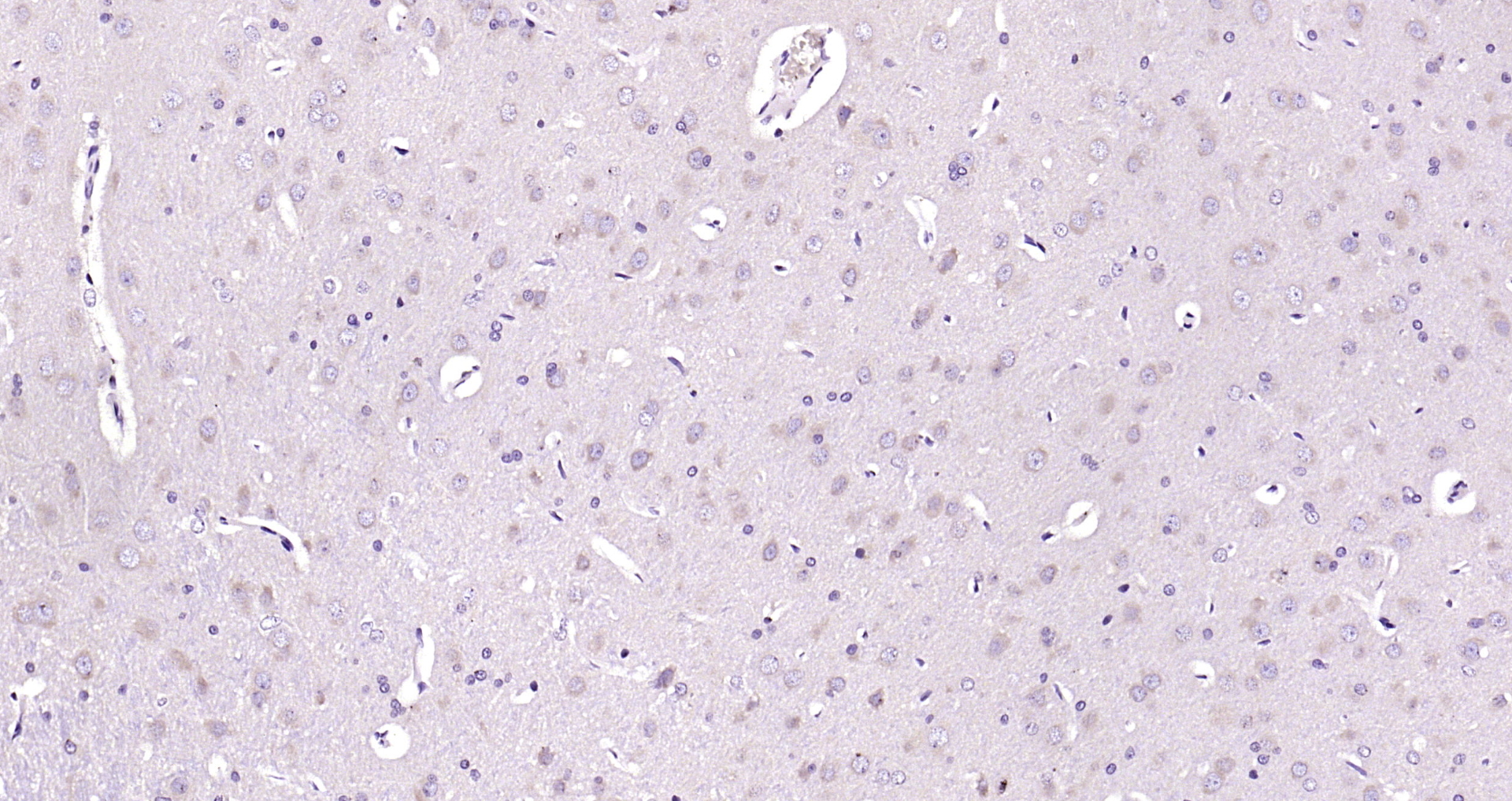 Paraformaldehyde-fixed, paraffin embedded Rat brain; Antigen retrieval by boiling in sodium citrate buffer (pH6.0) for 15min; Block endogenous peroxidase by 3% hydrogen peroxide for 20 minutes; Blocking buffer (normal goat serum) at 37°C for 30min; Antibody incubation with LIP5 Polyclonal Antibody, Unconjugated (bs-24470R) at 1:200 overnight at 4°C, DAB staining. Paraformaldehyde-fixed, paraffin embedded Rat brain; Antigen retrieval by boiling in sodium citrate buffer (pH6.0) for 15min; Block endogenous peroxidase by 3% hydrogen peroxide for 20 minutes; Blocking buffer (normal goat serum) at 37°C for 30min; Antibody incubation with LIP5 Polyclonal Antibody, Unconjugated (bs-24470R) at 1:200 overnight at 4°C, DAB staining.