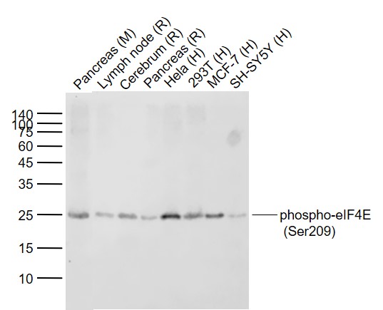 Lane 1: Mouse Pancreas tissue lysates; Lane 2:Rat Lymph node tissue lysates; Lane 3: Rat Cerebrum tissue lysates; Lane 4: Rat Pancreas tissue lysates ; Lane 5: Human Hela cell lysates;Lane 6: Human 293T cell lysates ;Lane 7: Human MCF-7 cell lysates; Lane 8: Human SH-SY5Y cell lysates probed with eIF4E(S209) (2B1) Monoclonal Antibody, Unconjugated (bsm-52152R) at 1:1000 dilution and 4˚C overnight incubation. Followed by conjugated secondary antibody incubation at 1:20000 for 60 min at 37˚C.
