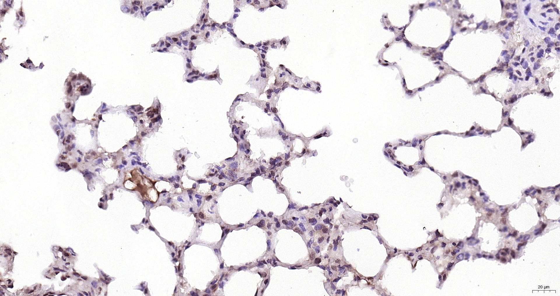 Paraformaldehyde-fixed, paraffin embedded Rat lung; Antigen retrieval by boiling in sodium citrate buffer (pH6.0) for 15min; Block endogenous peroxidase by 3% hydrogen peroxide for 20 minutes; Blocking buffer (normal goat serum) at 37°C for 30min; Antibody incubation with Cyclophilin E Polyclonal Antibody, Unconjugated (bs-14138R) at 1:200 overnight at 4°C, DAB staining.