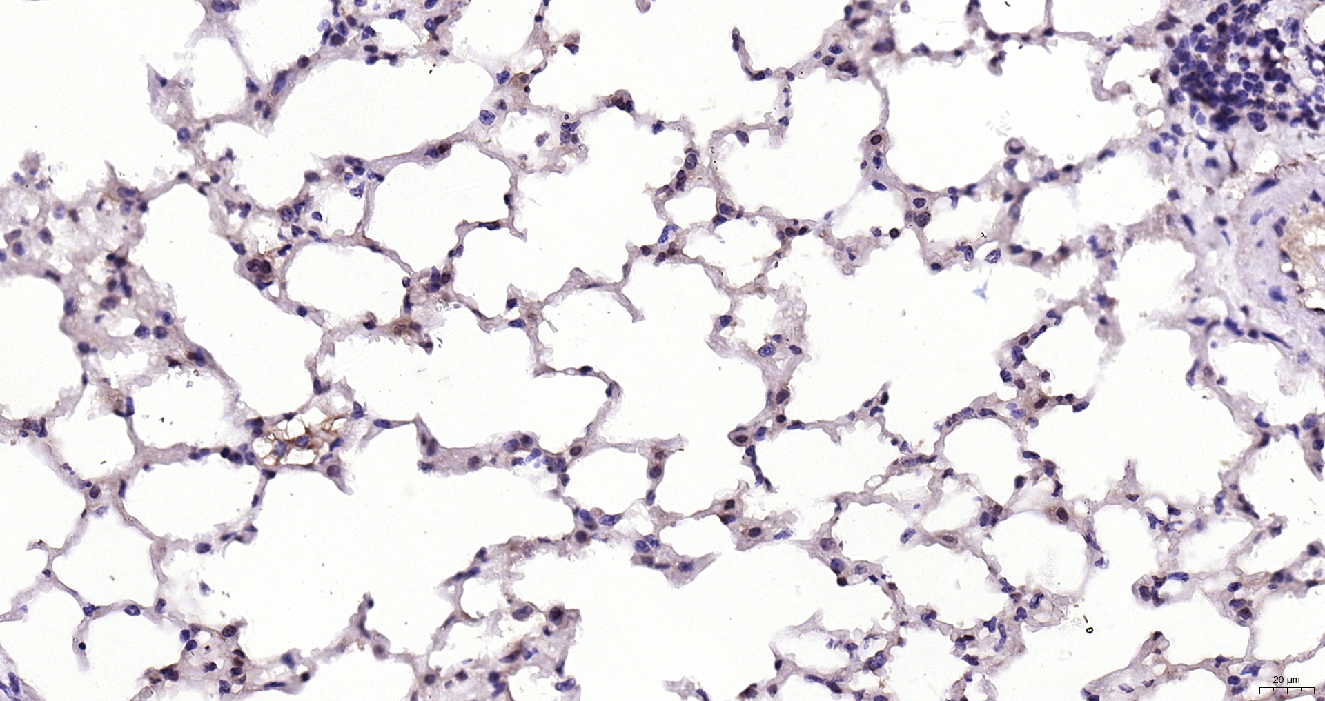 Paraformaldehyde-fixed, paraffin embedded Mouse lung; Antigen retrieval by boiling in sodium citrate buffer (pH6.0) for 15min; Block endogenous peroxidase by 3% hydrogen peroxide for 20 minutes; Blocking buffer (normal goat serum) at 37°C for 30min; Antibody incubation with Cyclophilin E Polyclonal Antibody, Unconjugated (bs-14138R) at 1:200 overnight at 4°C, DAB staining.
