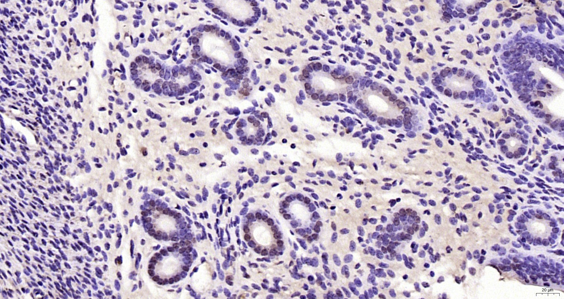 Paraformaldehyde-fixed, paraffin embedded Mouse uterus; Antigen retrieval by boiling in sodium citrate buffer (pH6.0) for 15min; Block endogenous peroxidase by 3% hydrogen peroxide for 20 minutes; Blocking buffer (normal goat serum) at 37°C for 30min; Antibody incubation with MCM-BP Polyclonal Antibody, Unconjugated (bs-18727R) at 1:200 overnight at 4°C, DAB staining.