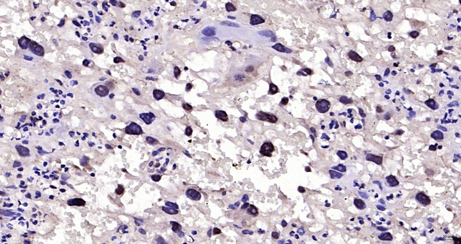 Paraformaldehyde-fixed, paraffin embedded Rat placenta; Antigen retrieval by boiling in sodium citrate buffer (pH6.0) for 15min; Block endogenous peroxidase by 3% hydrogen peroxide for 20 minutes; Blocking buffer (normal goat serum) at 37°C for 30min; Antibody incubation with HAND2 Polyclonal Antibody, Unconjugated (bs-22974R) at 1:200 overnight at 4°C, DAB staining.