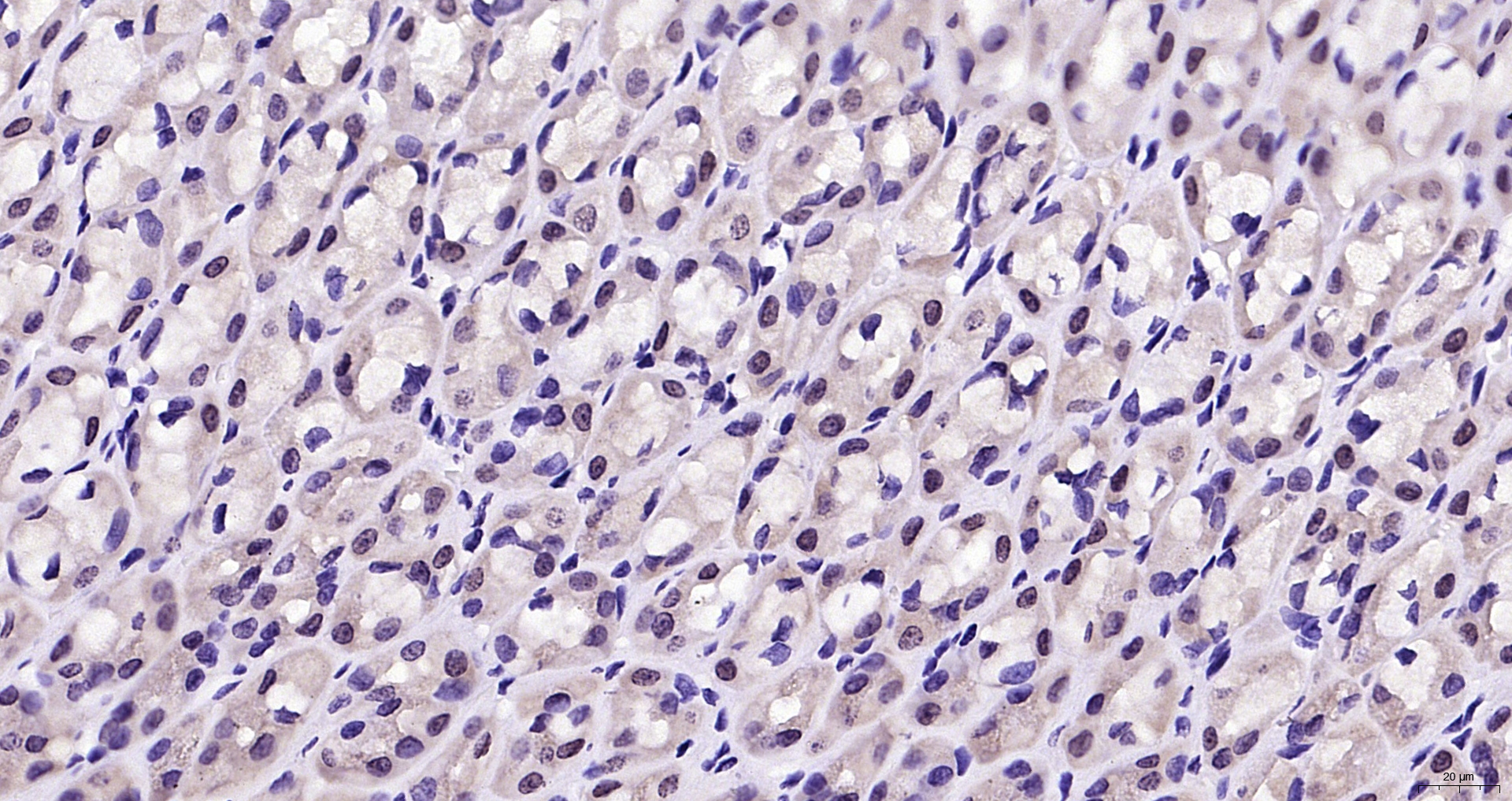 Paraformaldehyde-fixed, paraffin embedded Rat stomach; Antigen retrieval by boiling in sodium citrate buffer (pH6.0) for 15min; Block endogenous peroxidase by 3% hydrogen peroxide for 20 minutes; Blocking buffer (normal goat serum) at 37°C for 30min; Antibody incubation with Cux2 Polyclonal Antibody, Unconjugated (bs-23125R) at 1:200 overnight at 4°C, DAB staining. Paraformaldehyde-fixed, paraffin embedded Rat stomach; Antigen retrieval by boiling in sodium citrate buffer (pH6.0) for 15min; Block endogenous peroxidase by 3% hydrogen peroxide for 20 minutes; Blocking buffer (normal goat serum) at 37°C for 30min; Antibody incubation with Cux2 Polyclonal Antibody, Unconjugated (bs-23125R) at 1:200 overnight at 4°C, DAB staining.