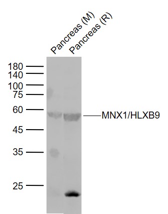 Lane 1: Mouse Pancreas tissue lysates; Lane 2: Rat Pancreas tissue lysates probed with HB9/HLXB9 Polyclonal Antibody, Unconjugated (bs-11320R) at 1:1000 dilution and 4˚C overnight incubation. Followed by conjugated secondary antibody incubation at 1:20000 for 60 min at 37˚C.