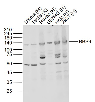 Lane 1: Mouse Uterus tissue lysates; Lane 2: Rat Testis tissue lysates; Lane 3: Human Huvec cell lysates; Lane 4: Human U87MG cell lysates ; Lane 5: Human Hela cell lysates ; Lane 6: Human 293T cell lysates probed with BBS9 Polyclonal Antibody, Unconjugated (bs-11511R) at 1:1000 dilution and 4˚C overnight incubation. Followed by conjugated secondary antibody incubation at 1:20000 for 60 min at 37˚C.