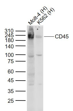 Lane 1: Human Molt-4 cell lysates; Lane 2: Human K562 cell lysates probed with CD45 Monoclonal Antibody, Unconjugated (bsm-33052M) at 1:1000 dilution and 4˚C overnight incubation. Followed by conjugated secondary antibody incubation at 1:20000 for 60 min at 37˚C.
