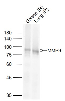 Lane 1: Rat Spleen tissue lysates; Lane 2: Rat Lung tissue lysates probed with MMP9 (7D6) Monoclonal Antibody, Unconjugated (bsm-54040R) at 1:1000 dilution and 4˚C overnight incubation. Followed by conjugated secondary antibody incubation at 1:20000 for 60 min at 37˚C.