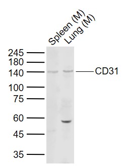 Lane 1: Mouse Spleen tissue lysates; Lane 2: Mouse Lung tissue lysates probed with CD31 Polyclonal Antibody, Unconjugated (bs-0195R) at 1:1000 dilution and 4˚C overnight incubation. Followed by conjugated secondary antibody incubation at 1:20000 for 60 min at 37˚C.