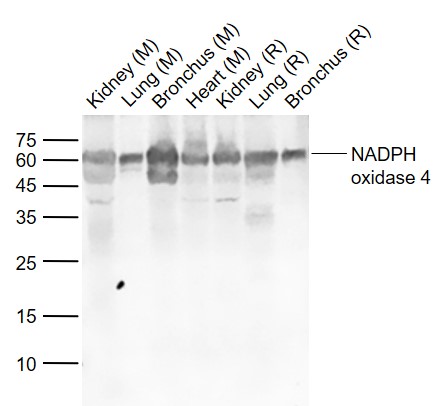 Lane 1: Mouse Kidney tissue lysates; Lane 2: Mouse Lung tissue lysates; Lane 3: Mouse Bronchus tissue lysates; Lane 4: Mouse Heart tissue lysates ; Lane 5: Rat Kidney tissue lysates; Lane 6: Rat Lung tissue lysates; Lane 7: Rat Bronchus tissue lysates probed with NADPH oxidase 4 Polyclonal Antibody, Unconjugated (bs-1091R) at 1:1000 dilution and 4˚C overnight incubation. Followed by conjugated secondary antibody incubation at 1:20000 for 60 min at 37˚C. Lane 1: Mouse Kidney tissue lysates; Lane 2: Mouse Lung tissue lysates; Lane 3: Mouse Bronchus tissue lysates; Lane 4: Mouse Heart tissue lysates ; Lane 5: Rat Kidney tissue lysates; Lane 6: Rat Lung tissue lysates; Lane 7: Rat Bronchus tissue lysates probed with NADPH oxidase 4 Polyclonal Antibody, Unconjugated (bs-1091R) at 1:1000 dilution and 4˚C overnight incubation. Followed by conjugated secondary antibody incubation at 1:20000 for 60 min at 37˚C.