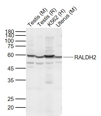 Lane 1: Mouse Testis tissue lysates; Lane 2: Rat Testis tissue lysates; Lane 3: Human K562 cell lysates; Lane 4: Mouse Uterus tissue lysates probed with RALDH2 Polyclonal Antibody, Unconjugated (bs-3676R) at 1:1000 dilution and 4˚C overnight incubation. Followed by conjugated secondary antibody incubation at 1:20000 for 60 min at 37˚C.