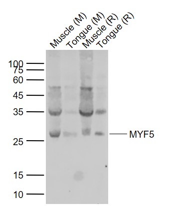 Lane 1: Mouse Muscle tissue lysates; Lane 2: Mouse Tongue tissue lysates; Lane 3: Rat Muscle tissue lysates; Lane 4: Rat Tongue tissue lysates probed with MYF5 Polyclonal Antibody, Unconjugated (bs-6936R) at 1:1000 dilution and 4˚C overnight incubation. Followed by conjugated secondary antibody incubation at 1:20000 for 60 min at 37˚C.
