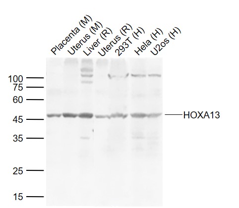 Lane 1: Mouse Placenta tissue lysates; Lane 2: Mouse Uterus tissue lysates; Lane 3: Rat Liver tissue lysates; Lane 4: Rat Uterus tissue lysates ; Lane 5: Human 293T cell lysates; Lane 6: Human Hela cell lysates; Lane 7: Human U2os cell lysates probed with HOXA13 Polyclonal Antibody, Unconjugated (bs-12244R) at 1:1000 dilution and 4˚C overnight incubation. Followed by conjugated secondary antibody incubation at 1:20000 for 60 min at 37˚C._x000D_