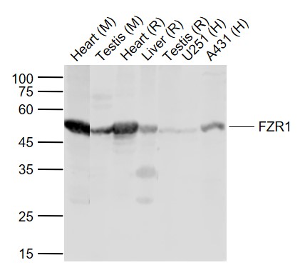 Lane 1: Mouse Heart tissue lysates; Lane 2: Mouse Testis tissue lysates; Lane 3: Rat Heart tissue lysates; Lane 4: Rat Liver tissue lysates ; Lane 5: Rat Testis tissue lysates; Lane 6: Human U251 cell lysates; Lane 7: Human A431 cell lysates probed with FZR1/CDC20C Polyclonal Antibody, Unconjugated (bs-13240R) at 1:1000 dilution and 4˚C overnight incubation. Followed by conjugated secondary antibody incubation at 1:20000 for 60 min at 37˚C._x000D_