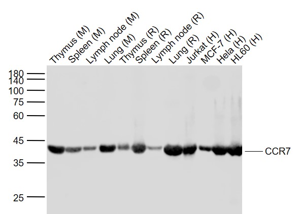 Lane 1: Mouse Thymus tissue lysates; Lane 2: Mouse Spleen tissue lysates; Lane 3: Mouse Lymph node tissue lysates; Lane 4: Mouse Lung tissue lysates ; Lane 5: Rat Thymus tissue lysates;Lane 6:Rat Spleen tissue lysates; Lane 7:Rat Lymph node tissue lysates; Lane 8: Rat Lung tissue lysates; Lane 9: Human Jurkat cell lysates; Lane 10: Human MCF-7 cell lysates; Lane 11: Human Hela cell lysates ; Lane 12: Human HL60 cell lysates probed with CCR7 (1G8) Monoclonal Antibody, Unconjugated (bsm-52274R) at 1:1000 dilution and 4˚C overnight incubation. Followed by conjugated secondary antibody incubation at 1:20000 for 60 min at 37˚C.
