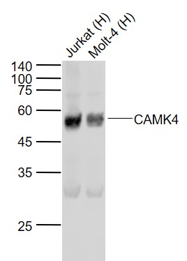 Lane 1: Human Jurkat cell lysates; Lane 2: Human Molt-4 cell lysates probed with CAMK4 (3F11) Monoclonal Antibody, Unconjugated (bsm-54336R) at 1:1000 dilution and 4˚C overnight incubation. Followed by conjugated secondary antibody incubation at 1:20000 for 60 min at 37˚C.