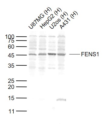 Lane 1: Human U87MG cell lysates; Lane 2: Human HepG2 cell lysates; Lane 3: Human U2os cell lysates; Lane 4: Human A431 cell lysates probed with FENS1 Polyclonal Antibody, Unconjugated (bs-13169R) at 1:1000 dilution and 4°C overnight incubation. Followed by conjugated secondary antibody incubation at 1:20000 for 60 min at 37˚C.