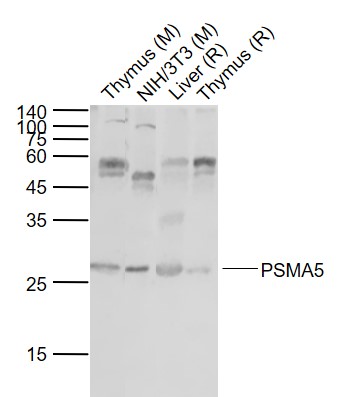 Lane 1: Mouse Thymus tissue lysates; Lane 2: Mouse NIH/3T3 cell lysates; Lane 3: Rat Liver Tissue lysates; Lane 4: Rat Thymus tissue lysates probed with PSMA5 Polyclonal Antibody,Unconjugated (bs-9354R) at 1:1000 dilution and 4°C overnight incubation. Followed by conjugated secondary antibody incubation at 1:20000 for 60 min at 37˚C.