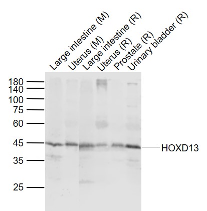 Lane 1: Mouse Large intestine tissue lysates; Lane 2: Mouse Uterus tissue lysates; Lane 3: Rat Large intestine tissue lysates; Lane 4: Rat Uterus tissue lysates ; Lane 5: Rat Prostate tissue lysates ; Lane 6: Rat Urinary bladder tissue lysates probed with HOXD13 Polyclonal Antibody,Unconjugated (bs-12197R) at 1:1000 dilution and 4°C overnight incubation. Followed by conjugated secondary antibody incubation at 1:20000 for 60 min at 37˚C.