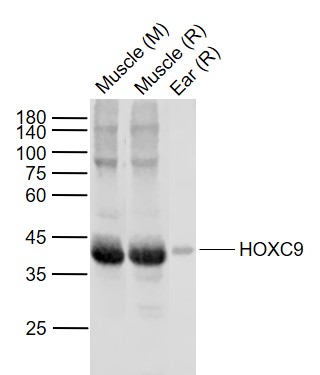 Lane 1: Mouse Muscle tissue lysates; Lane 2: Rat Muscle tissue lysates; Lane 3: Rat Ear tissue lysates probed with HOXC9 Polyclonal Antibody, Unconjugated (bs-7982R) at 1:200 dilution and 4°C overnight incubation. Followed by conjugated secondary antibody incubation at 1:20000 for 60 min at 37˚C.