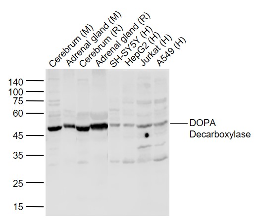 Lane 1: Mouse Cerebrum tissue lysates; Lane 2: Mouse adrenal gland tissue lysates; Lane 3: Rat Cerebrum tissue lysates; Lane 4: Rat adrenal gland tissue lysates ; Lane 5: Human SH-SY5Y cell lysates; Lane 6: Human HepG2 cell lysates; Lane 7: Human Jurkat cell lysates; Lane 8: Human A549 cell lysates probed with DOPA Decarboxylase Polyclonal Antibody,Unconjugated (bs-0180R) at 1:1000 dilution and 4°C overnight incubation. Followed by conjugated secondary antibody incubation at 1:20000 for 60 min at 37˚C.