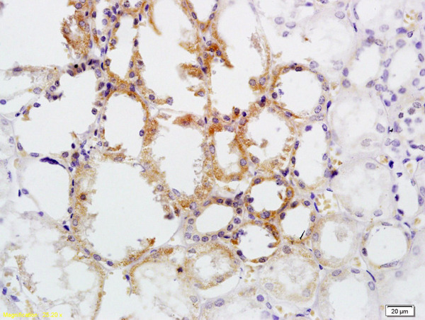 Formalin-fixed and paraffin embedded human kidney tissue labeled with Anti CD30\/TNFRSF8\/CD153 Polyclonal Antibody, Unconjugated (bs-2495R) at 1:200 followed by conjugation to the secondary antibody and DAB staining