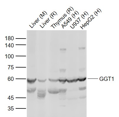 Lane 1: Mouse Liver tissue lysates; Lane 2: Rat Liver tissue lysates; Lane 3: Rat Thymus tissue lysates; Lane 4: Human A549 cell lysates ; Lane 5: Human U937 cell lysates ; Lane 6: Human HepG2 cell lysates probed with GGT1 Polyclonal Antibody,Unconjugated (bs-2976R) at 1:1000 dilution and 4°C overnight incubation. Followed by conjugated secondary antibody incubation at 1:20000 for 60 min at 37˚C.