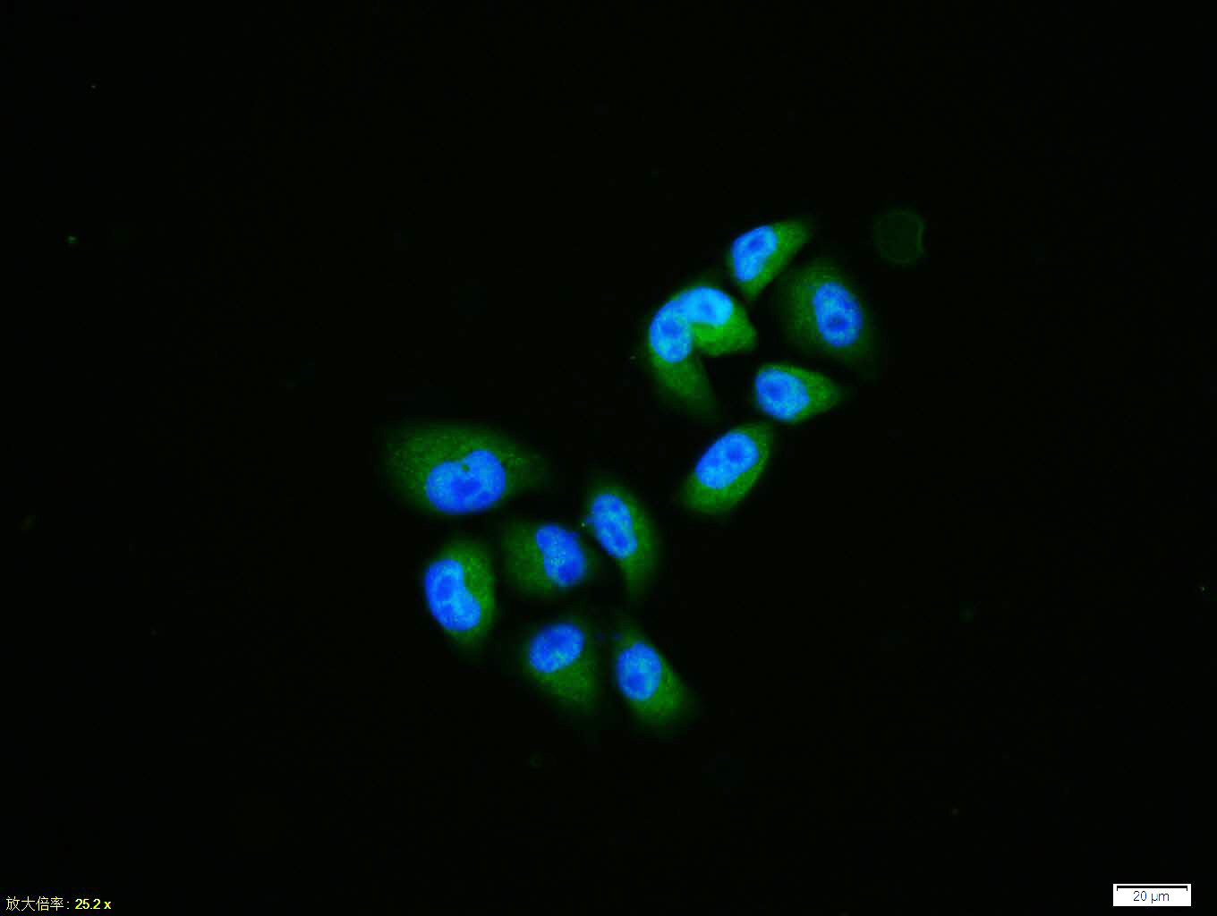 Hela cell; 4% Paraformaldehyde-fixed; Triton X-100 at room temperature for 20 min; Blocking buffer (normal goat serum, C-0005) at 37°C for 20 min; Antibody incubation with (Nurr1) polyclonal Antibody, Unconjugated (bs-20744R) 1:100, 90 minutes at 37°C; followed by a conjugated Goat Anti-Rabbit IgG antibody at 37°C for 90 minutes, DAPI (blue, C02-04002) was used to stain the cell nuclei.