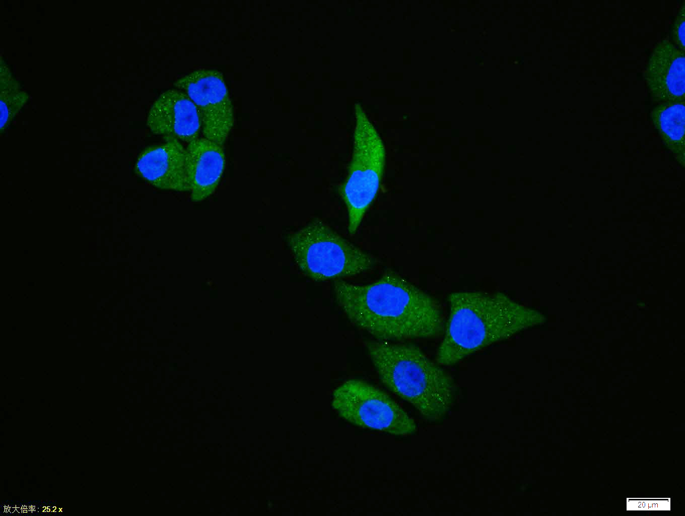 Hela cell; 4% Paraformaldehyde-fixed; Triton X-100 at room temperature for 20 min; Blocking buffer (normal goat serum, C-0005) at 37°C for 20 min; Antibody incubation with (Phospho-TAK1 (Ser192)) polyclonal Antibody, Unconjugated (bs-5435R) 1:100, 90 minutes at 37°C; followed by a conjugated Goat Anti-Rabbit IgG antibody at 37°C for 90 minutes, DAPI (blue, C02-04002) was used to stain the cell nuclei.