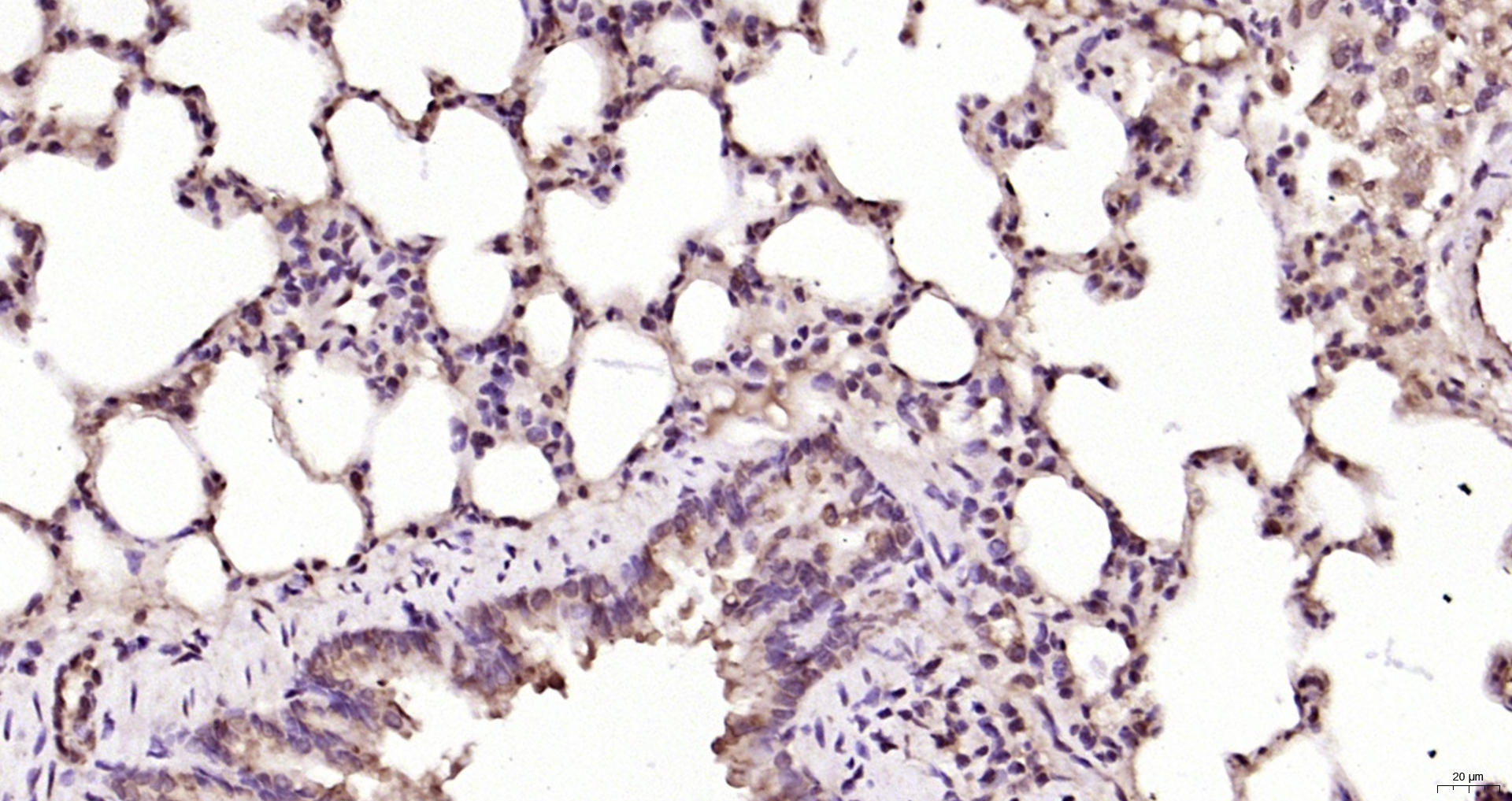 Paraformaldehyde-fixed, paraffin embedded Rat lung; Antigen retrieval by boiling in sodium citrate buffer (pH6.0) for 15min; Block endogenous peroxidase by 3% hydrogen peroxide for 20 minutes; Blocking buffer (normal goat serum) at 37°C for 30min; Antibody incubation with Ferritin heavy chain Polyclonal Antibody, Unconjugated (bs-5907R) at 1:200 overnight at 4°C, DAB staining.