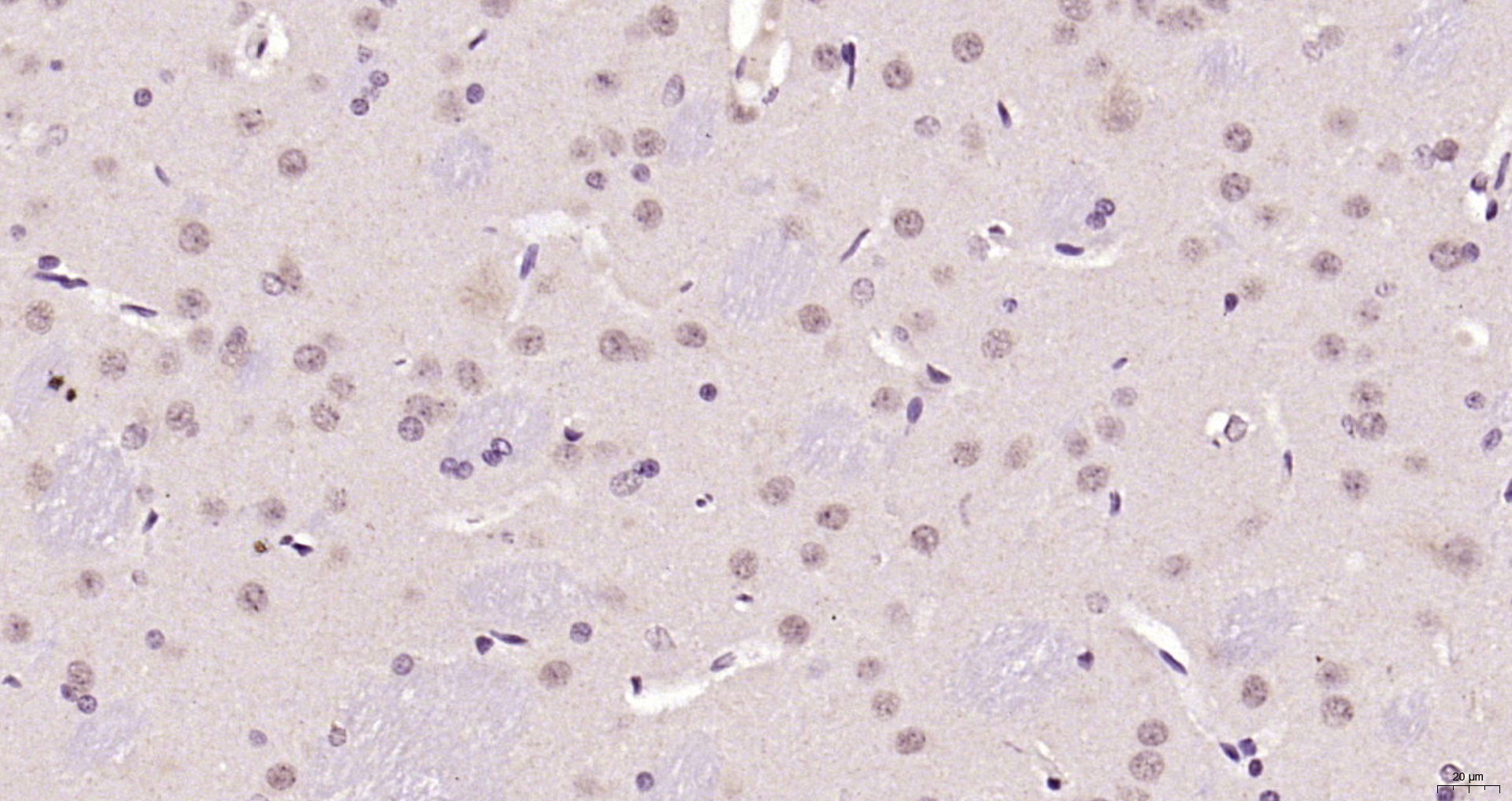 Paraformaldehyde-fixed, paraffin embedded Rat brain; Antigen retrieval by boiling in sodium citrate buffer (pH6.0) for 15min; Block endogenous peroxidase by 3% hydrogen peroxide for 20 minutes; Blocking buffer (normal goat serum) at 37°C for 30min; Antibody incubation with Ferritin heavy chain Polyclonal Antibody, Unconjugated (bs-5907R) at 1:200 overnight at 4°C, DAB staining.