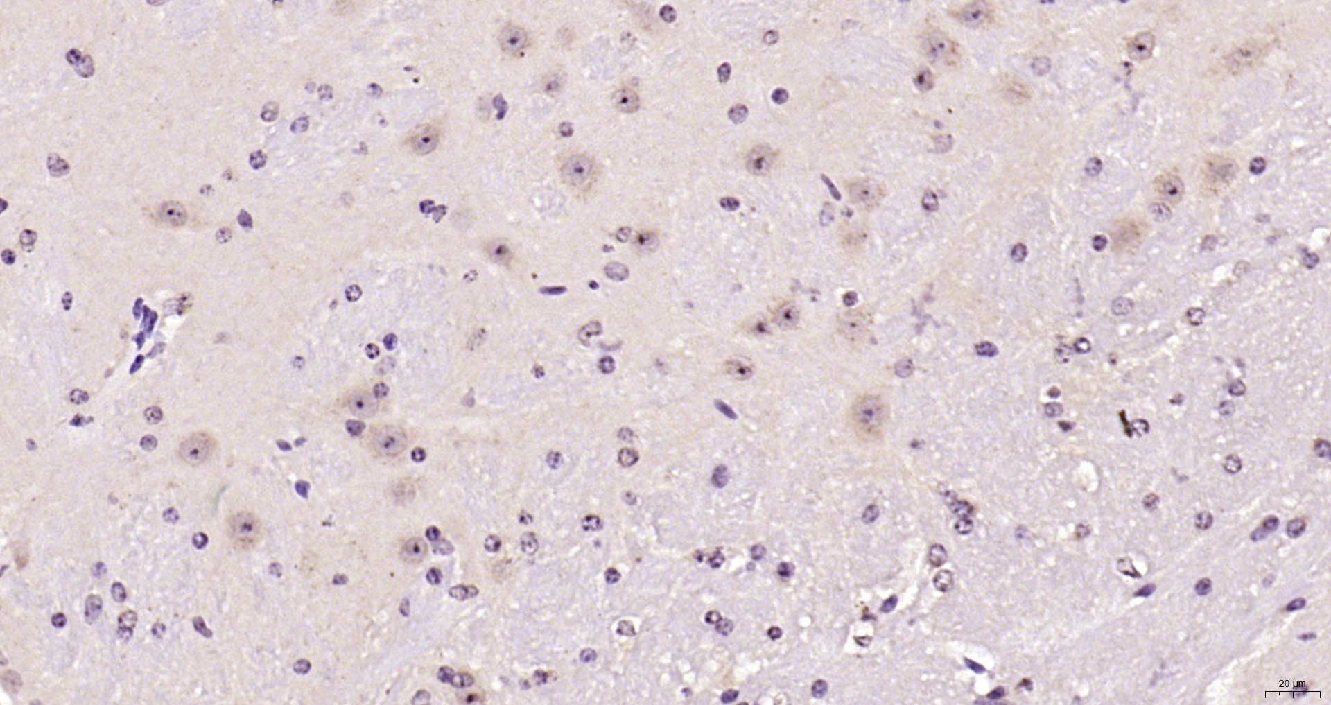 Paraformaldehyde-fixed, paraffin embedded Mouse brain; Antigen retrieval by boiling in sodium citrate buffer (pH6.0) for 15min; Block endogenous peroxidase by 3% hydrogen peroxide for 20 minutes; Blocking buffer (normal goat serum) at 37°C for 30min; Antibody incubation with Ferritin heavy chain Polyclonal Antibody, Unconjugated (bs-5907R) at 1:200 overnight at 4°C, DAB staining.