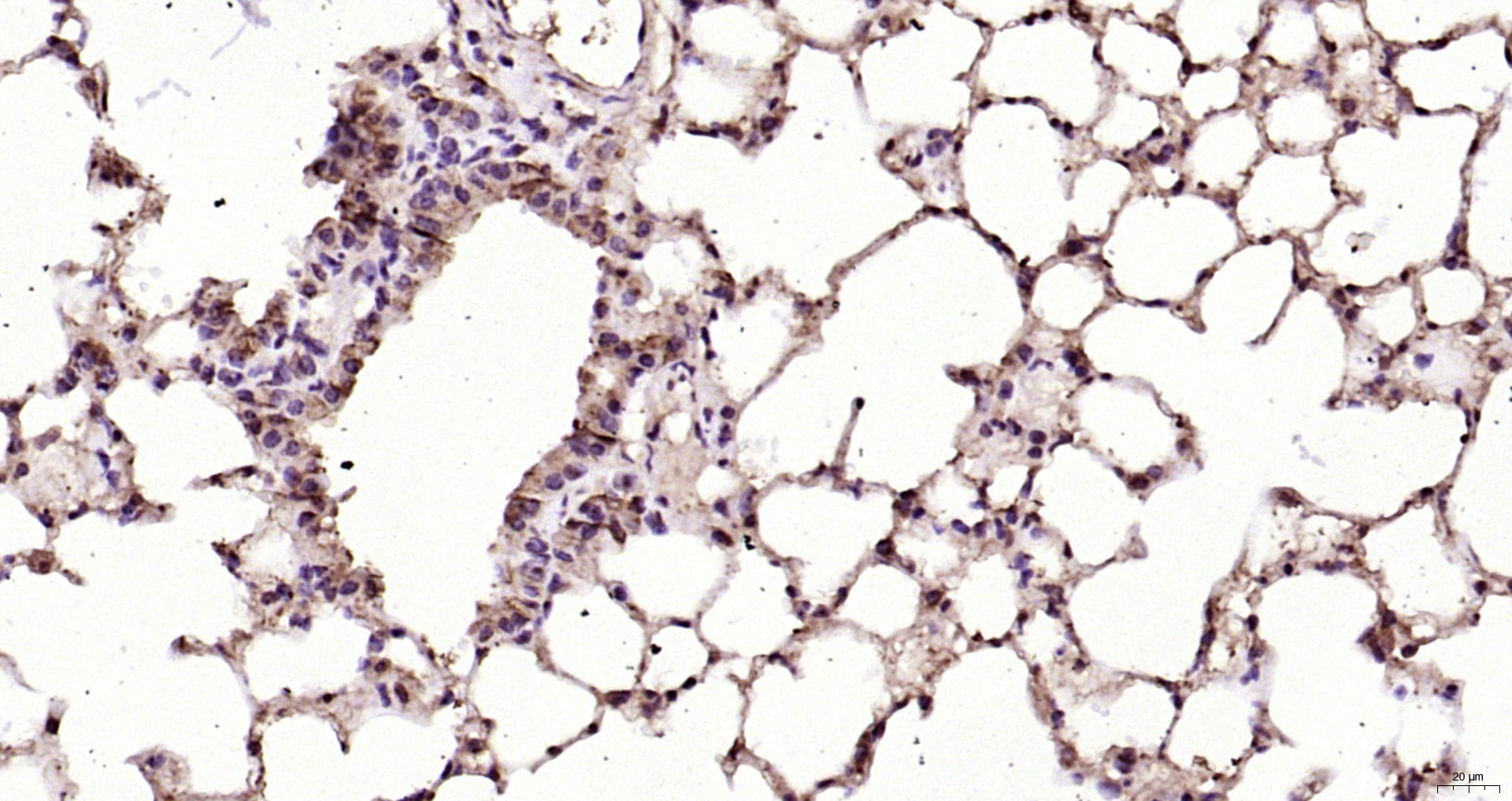 Paraformaldehyde-fixed, paraffin embedded Mouse lung; Antigen retrieval by boiling in sodium citrate buffer (pH6.0) for 15min; Block endogenous peroxidase by 3% hydrogen peroxide for 20 minutes; Blocking buffer (normal goat serum) at 37°C for 30min; Antibody incubation with Ferritin heavy chain Polyclonal Antibody, Unconjugated (bs-5907R) at 1:200 overnight at 4°C, DAB staining.