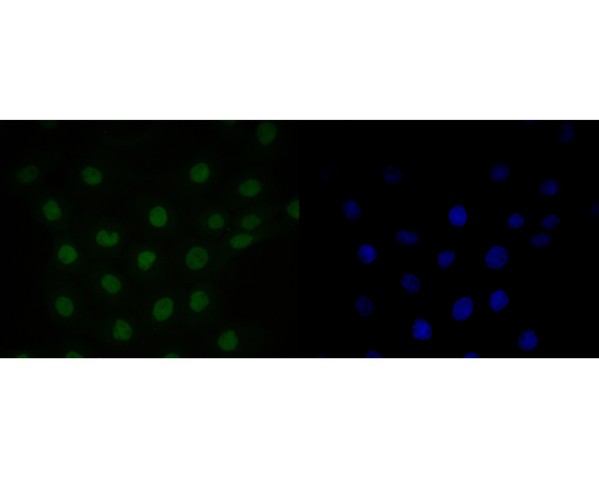 A431 cell; 4% Paraformaldehyde-fixed; Triton X-100 at room temperature for 20 min; Blocking buffer (normal goat serum, C-0005) at 37°C for 20 min; Antibody incubation with (HMGN2) monoclonal Antibody, Unconjugated (bsm-54712RR) 1:50, 90 minutes at 37°C; followed by a conjugated Goat Anti-Rabbit IgG antibody at 37°C for 90 minutes, DAPI (blue, C02-04002) was used to stain the cell nuclei.