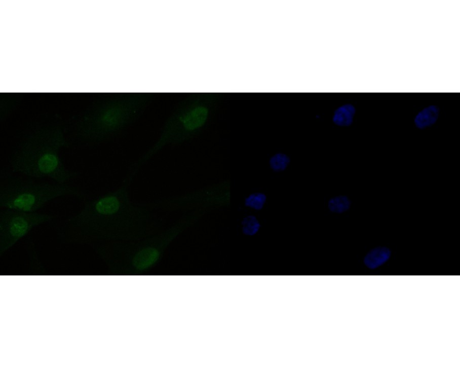 MG-63cell; 4% Paraformaldehyde-fixed; Triton X-100 at room temperature for 20 min; Blocking buffer (normal goat serum, C-0005) at 37°C for 20 min; Antibody incubation with (HMGN2) monoclonal Antibody, Unconjugated (bsm-54712R) 1:50, 90 minutes at 37°C; followed by a conjugated Goat Anti-Rabbit IgG antibody at 37°C for 90 minutes, DAPI (blue, C02-04002) was used to stain the cell nuclei.