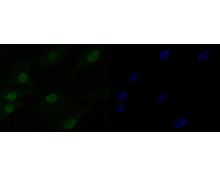 MG-63cell; 4% Paraformaldehyde-fixed; Triton X-100 at room temperature for 20 min; Blocking buffer (normal goat serum, C-0005) at 37°C for 20 min; Antibody incubation with (HMGN2) monoclonal Antibody, Unconjugated (bsm-54712R) 1:50, 90 minutes at 37°C; followed by a conjugated Goat Anti-Rabbit IgG antibody at 37°C for 90 minutes, DAPI (blue, C02-04002) was used to stain the cell nuclei.