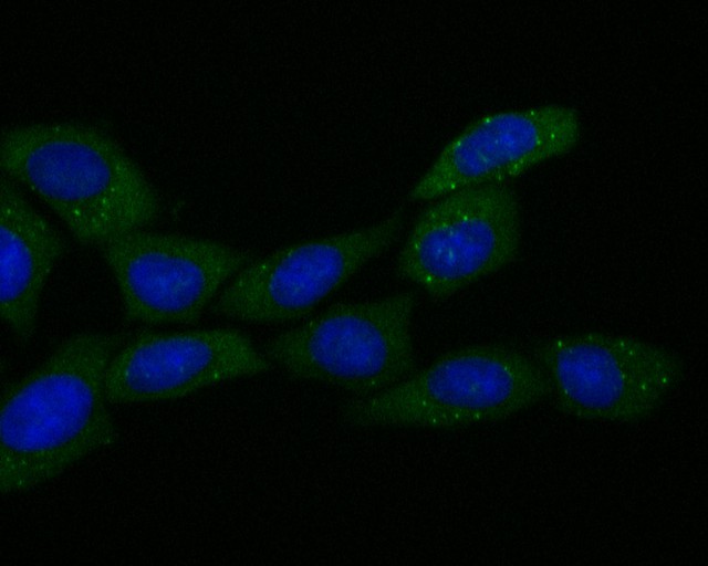 SiHa  cell; 4% Paraformaldehyde-fixed; Triton X-100 at room temperature for 20 min; Blocking buffer (normal goat serum, C-0005) at 37°C for 20 min; Antibody incubation with (ECM1) monoclonal Antibody, Unconjugated (bsm-54715R) 1:50, 90 minutes at 37°C; followed by a conjugated Goat Anti-Rabbit IgG antibody at 37°C for 90 minutes, DAPI (blue, C02-04002) was used to stain the cell nuclei.
