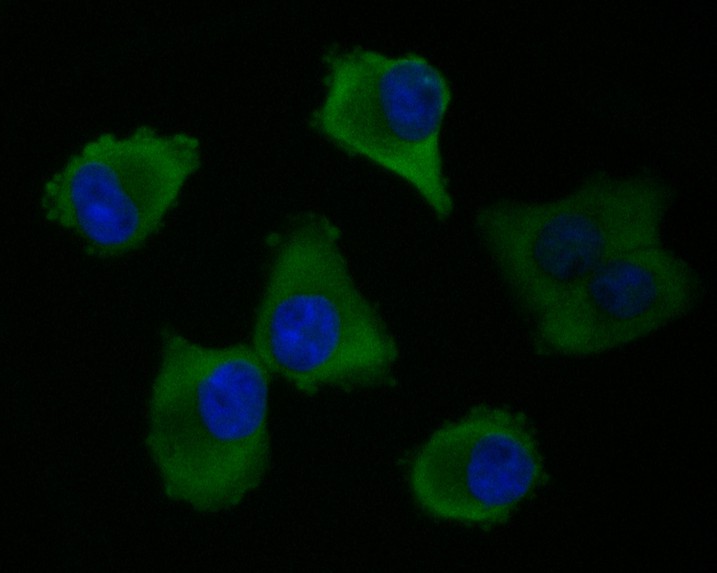 PANC-1 cell; 4% Paraformaldehyde-fixed; Triton X-100 at room temperature for 20 min; Blocking buffer (normal goat serum, C-0005) at 37°C for 20 min; Antibody incubation with (Elongation factor 1-gamma) monoclonal Antibody, Unconjugated (bsm-54719R) 1:50, 90 minutes at 37°C; followed by a conjugated Goat Anti-Rabbit IgG antibody at 37°C for 90 minutes, DAPI (blue, C02-04002) was used to stain the cell nuclei.