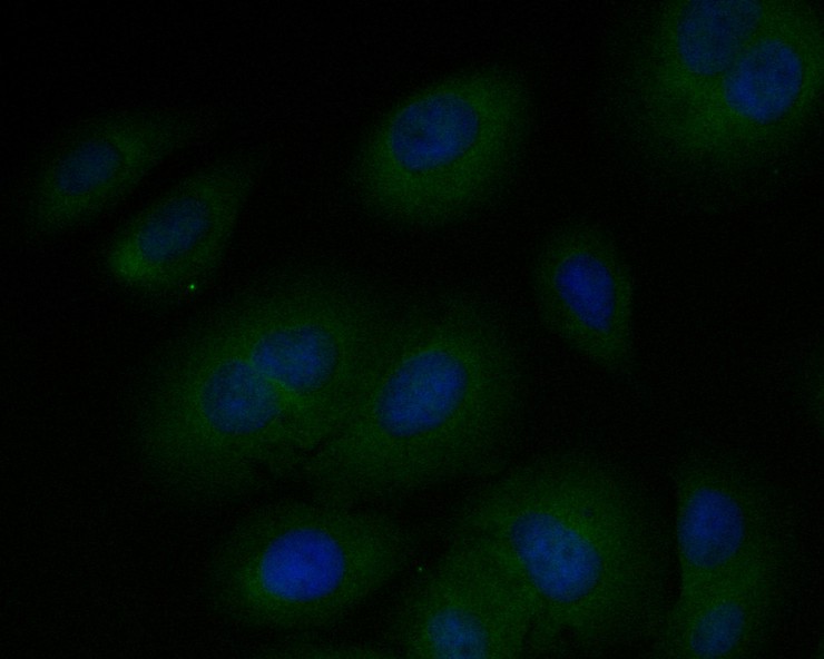SKOV-3 cell; 4% Paraformaldehyde-fixed; Triton X-100 at room temperature for 20 min; Blocking buffer (normal goat serum, C-0005) at 37°C for 20 min; Antibody incubation with (Elongation factor 1-gamma) monoclonal Antibody, Unconjugated (bsm-54719R) 1:50, 90 minutes at 37°C; followed by a conjugated Goat Anti-Rabbit IgG antibody at 37°C for 90 minutes, DAPI (blue, C02-04002) was used to stain the cell nuclei.