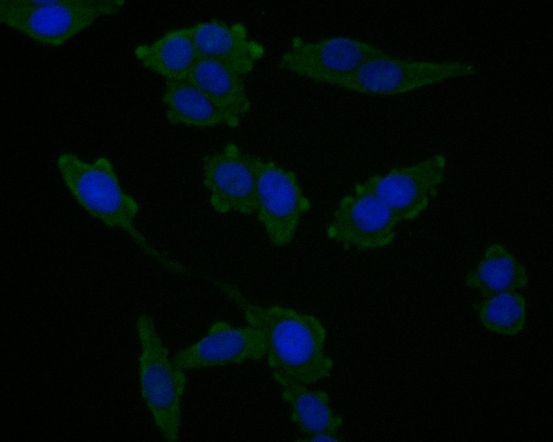 SW680 cell;4% Paraformaldehyde-fixed; Triton X-100 at room temperature for 20 min; Blocking buffer (normal goat serum, C-0005) at 37°C for 20 min; Antibody incubation with (CHMP2B) monoclonal Antibody, Unconjugated (bsm-54727R) 1:50, 90 minutes at 37°C; followed by a conjugated Goat Anti-Rabbit IgG antibody at 37°C for 90 minutes, DAPI (blue, C02-04002) was used to stain the cell nuclei.
