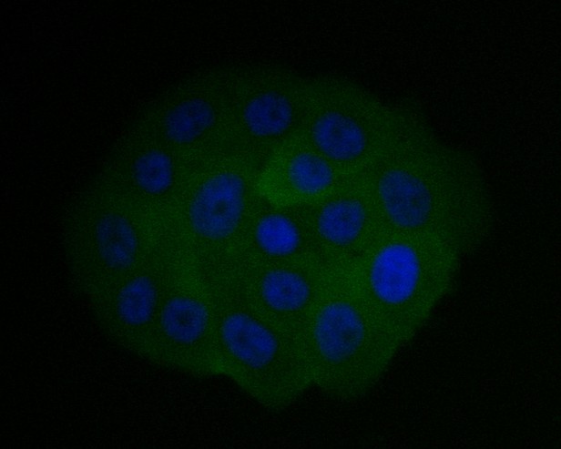 SW1990 cell;4% Paraformaldehyde-fixed; Triton X-100 at room temperature for 20 min; Blocking buffer (normal goat serum, C-0005) at 37°C for 20 min; Antibody incubation with (CHMP2B) monoclonal Antibody, Unconjugated (bsm-54727R) 1:50, 90 minutes at 37°C; followed by a conjugated Goat Anti-Rabbit IgG antibody at 37°C for 90 minutes, DAPI (blue, C02-04002) was used to stain the cell nuclei.